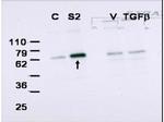 SMAD2 Polyclonal Antibody