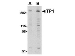 TEP1 Polyclonal Antibody