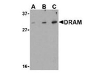 Damage Related Autophagy Modulator Polyclonal Antibody