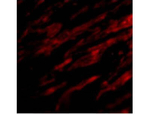 PDL1 Antibody in Immunocytochemistry (ICC/IF)