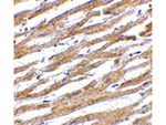 PDL1 Antibody in Immunohistochemistry (Paraffin) (IHC (P))