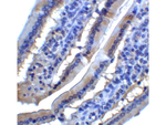 PDL1 Antibody in Immunohistochemistry (Paraffin) (IHC (P))