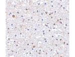 PDCD1 Polyclonal Antibody