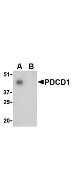 PDCD1 Antibody in Western Blot (WB)