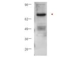 Protein Kinase C beta Polyclonal Antibody