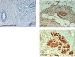 ABCB5 Antibody in Immunohistochemistry (Paraffin) (IHC (P))