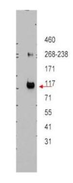 ABCB5 Antibody in Western Blot (WB)