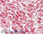MLF1 Antibody in Immunohistochemistry (Paraffin) (IHC (P))