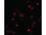 CaBP7 Antibody in Immunocytochemistry (ICC/IF)