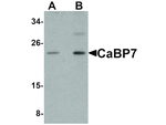CaBP7 Antibody in Western Blot (WB)