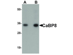 CaBP8 Polyclonal Antibody