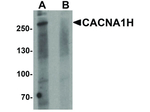 CACNA1H Polyclonal Antibody