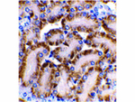 CAD Antibody in Immunohistochemistry (Paraffin) (IHC (P))