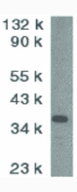 CAD Antibody in Western Blot (WB)