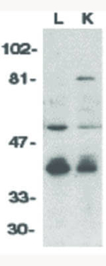 CAD Antibody in Western Blot (WB)