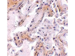 CAPN6 Antibody in Immunohistochemistry (Paraffin) (IHC (P))