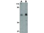 CAPN6 Antibody in Western Blot (WB)