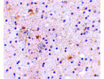 CAPS1 Antibody in Immunohistochemistry (Paraffin) (IHC (P))