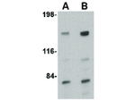 CAPS1 Antibody in Western Blot (WB)