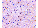 CAPS1 Antibody in Immunohistochemistry (Paraffin) (IHC (P))