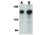 CAPS1 Antibody in Western Blot (WB)