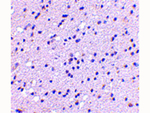 CAPS2 Antibody in Immunohistochemistry (Paraffin) (IHC (P))