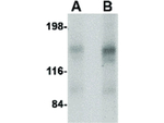 CAPS2 Antibody in Western Blot (WB)