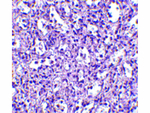 Carabin Polyclonal Antibody