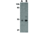 Carabin Antibody in Western Blot (WB)