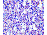 Carabin Polyclonal Antibody