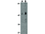 Carabin Antibody in Western Blot (WB)