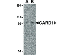 CARD10 Antibody in Western Blot (WB)