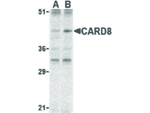 CARD8 Antibody in Western Blot (WB)