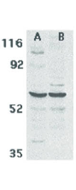 CARD9 Antibody in Western Blot (WB)
