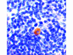 CARMA1 Antibody in Immunohistochemistry (Paraffin) (IHC (P))