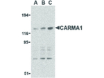CARMA1 Antibody in Western Blot (WB)