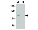 CASKIN2 Antibody in Western Blot (WB)