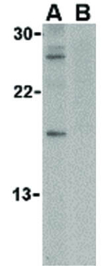 Caspase-14 Antibody in Western Blot (WB)