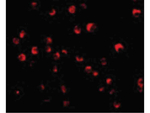 Caspase-8 Antibody in Immunocytochemistry (ICC/IF)