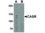 CASR Antibody in Western Blot (WB)