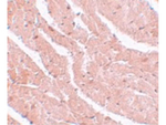 CAZIP Antibody in Immunohistochemistry (Paraffin) (IHC (P))
