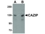 CAZIP Antibody in Western Blot (WB)
