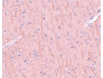 CCDC106 Antibody in Immunohistochemistry (Paraffin) (IHC (P))