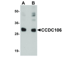 CCDC106 Antibody in Western Blot (WB)