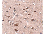 CCDC134 Antibody in Immunohistochemistry (Paraffin) (IHC (P))