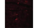CCDC47 Polyclonal Antibody
