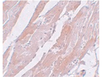 CCDC47 Antibody in Immunohistochemistry (Paraffin) (IHC (P))