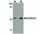 CCDC47 Antibody in Western Blot (WB)