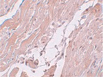 CCDC47 Antibody in Immunohistochemistry (Paraffin) (IHC (P))