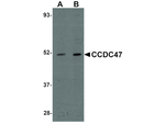 CCDC47 Antibody in Western Blot (WB)